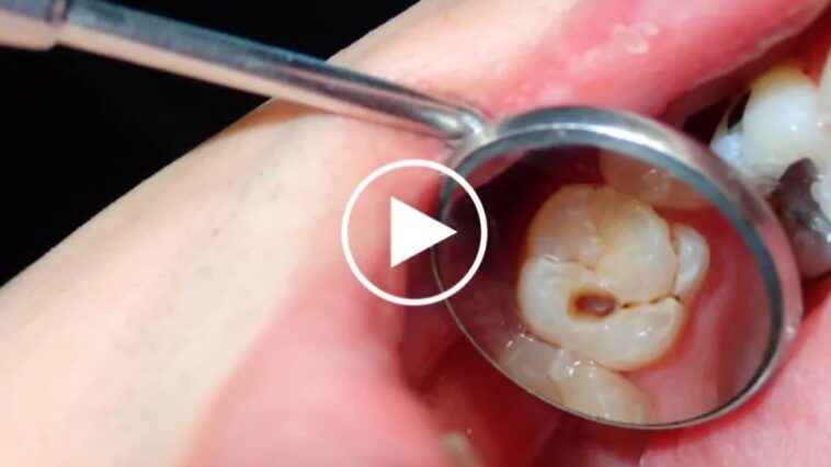 Dentes Saudáveis, Sorriso Radiante: Dicas para Cuidar da Estética Dental