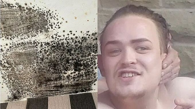 Jovem de 27 anos morre com fungo no pulmão depois de alugar casa infestada de mofo